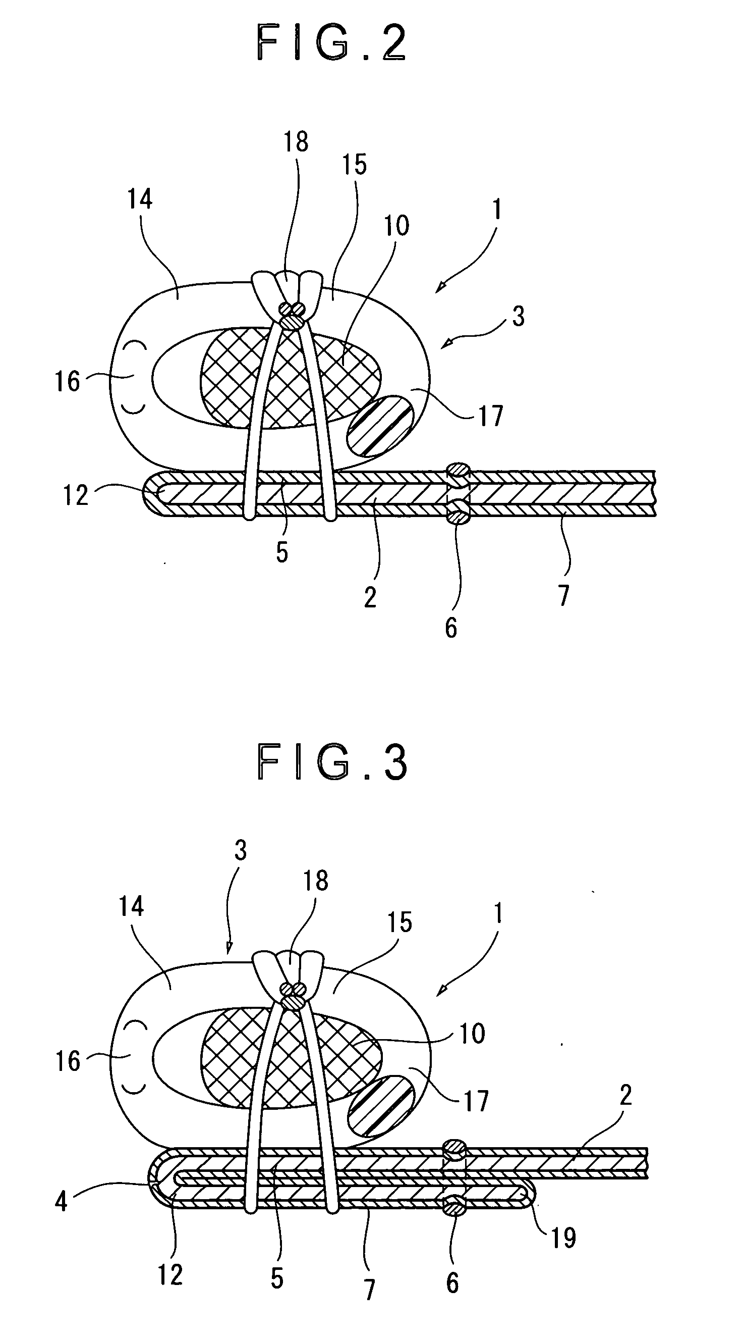 Slide fastener