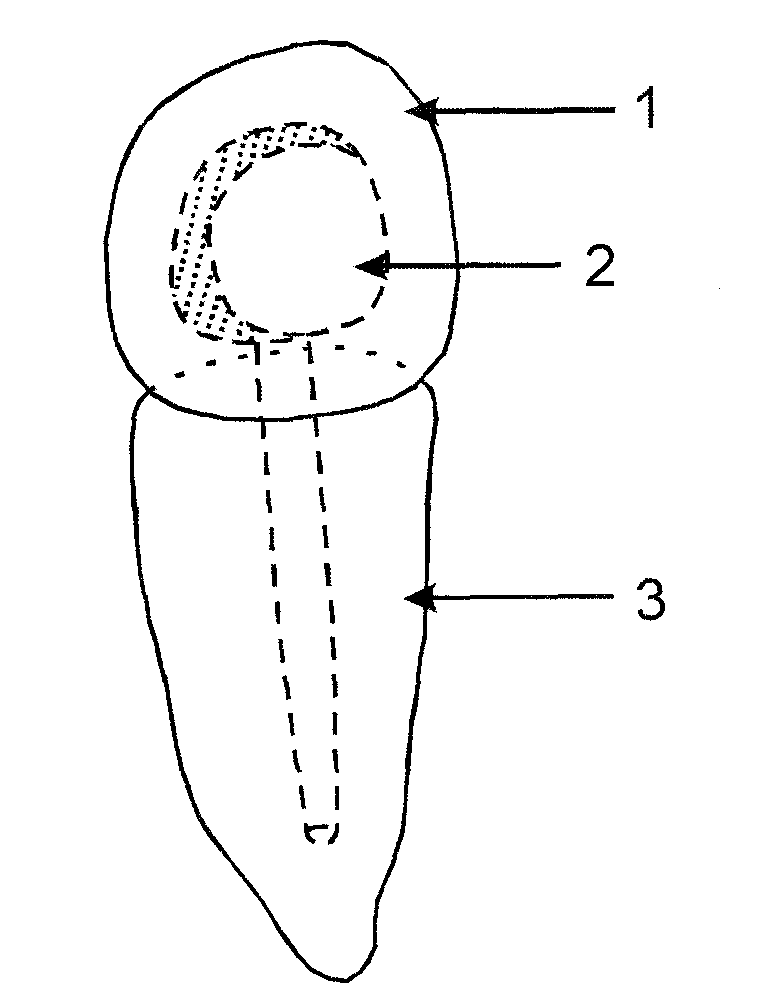 Integrated fiber post for dental restoration and preparation method thereof