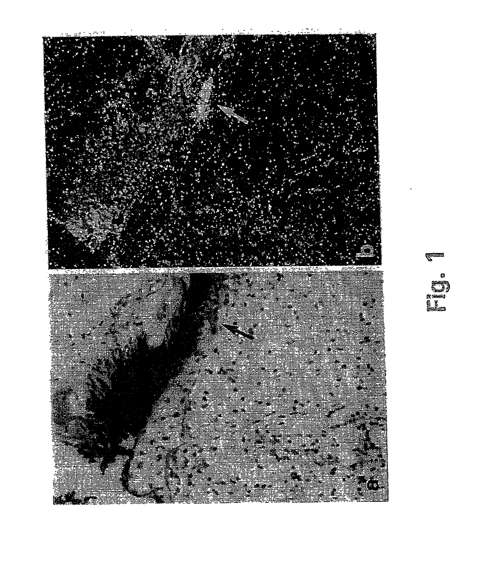 Inhibition of invasive remodelling