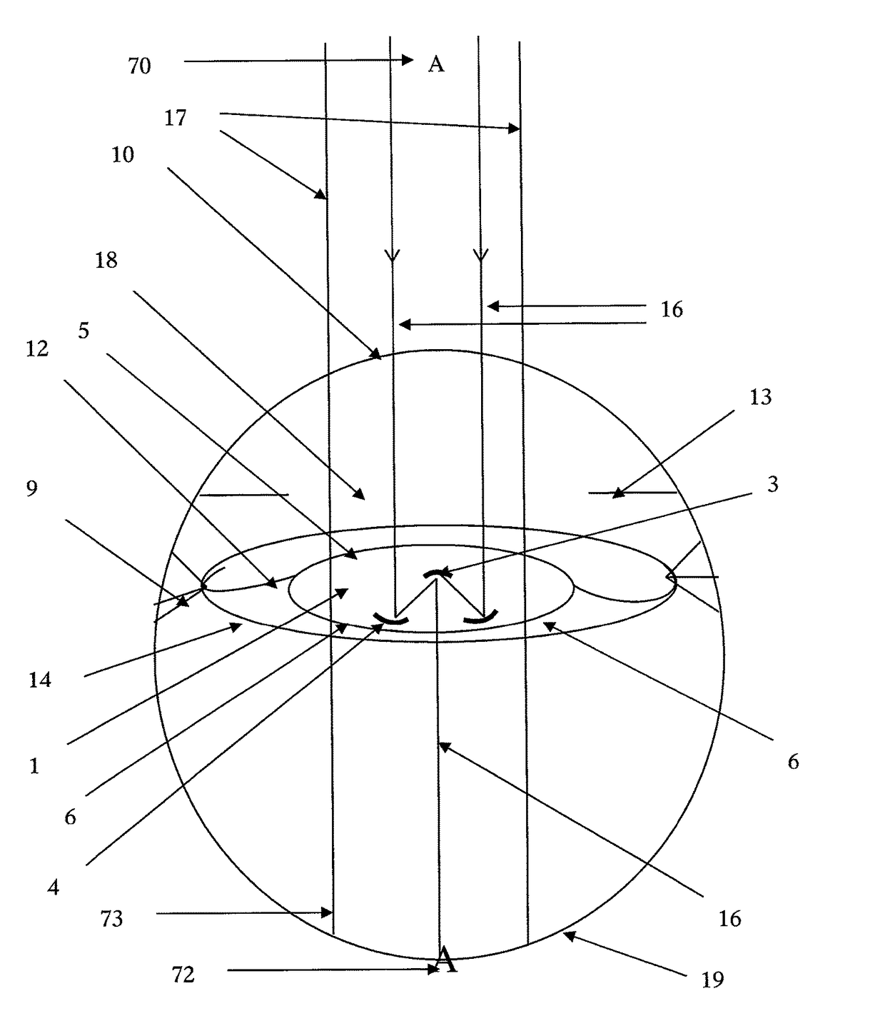 Intra-ocular implant