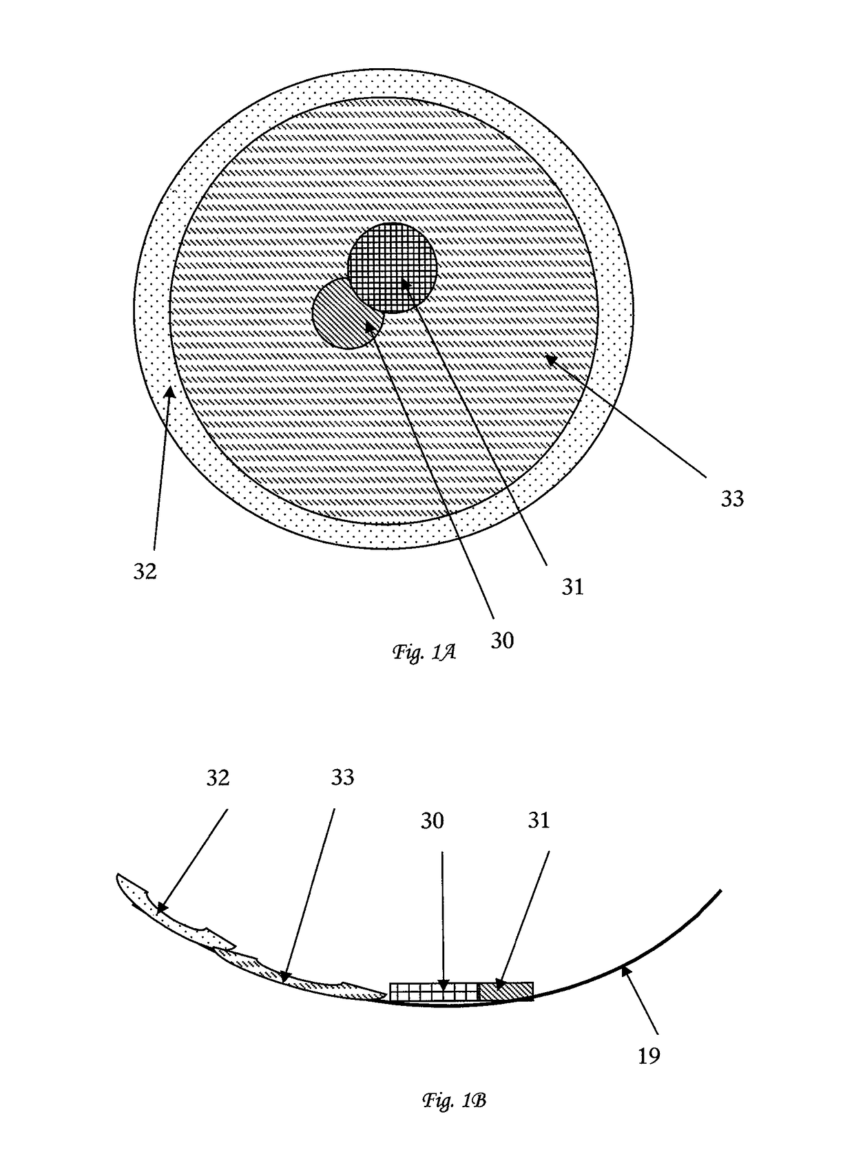 Intra-ocular implant