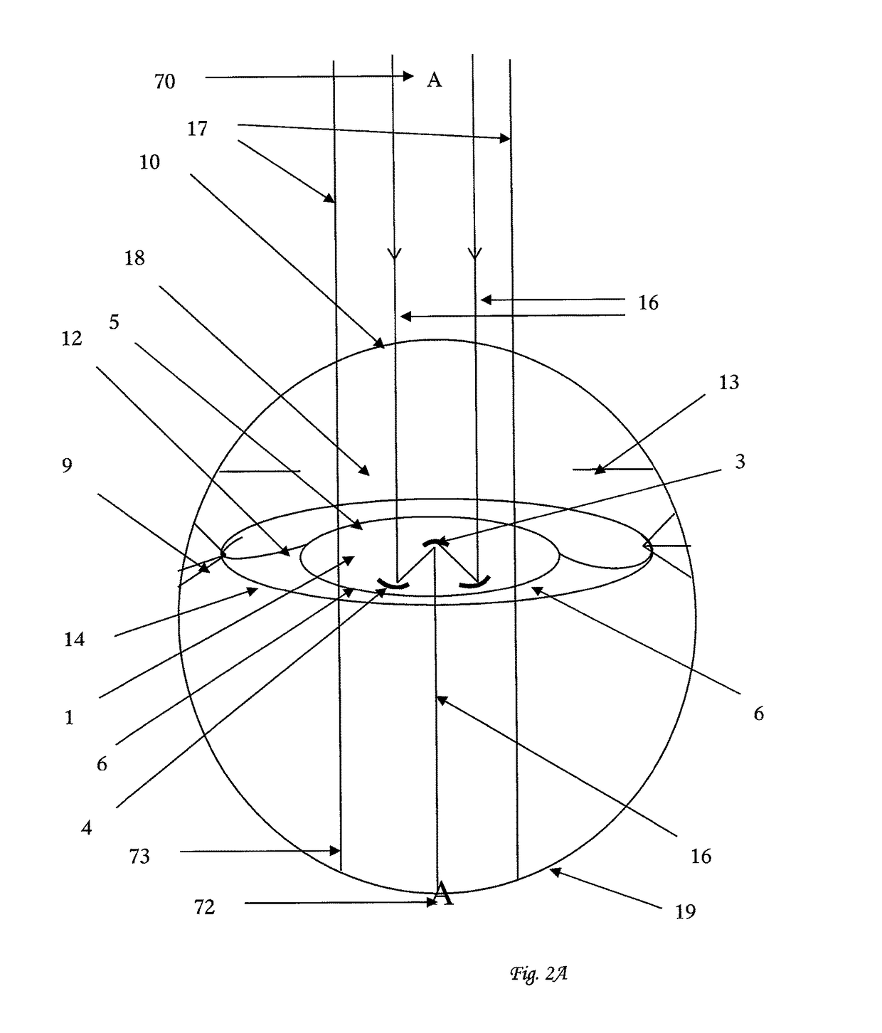 Intra-ocular implant