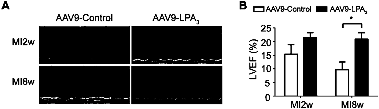 Application of lysophosphatidic acid, lysophosphatidic acid receptor 3 and lysophosphatidic acid receptor 3 agonist