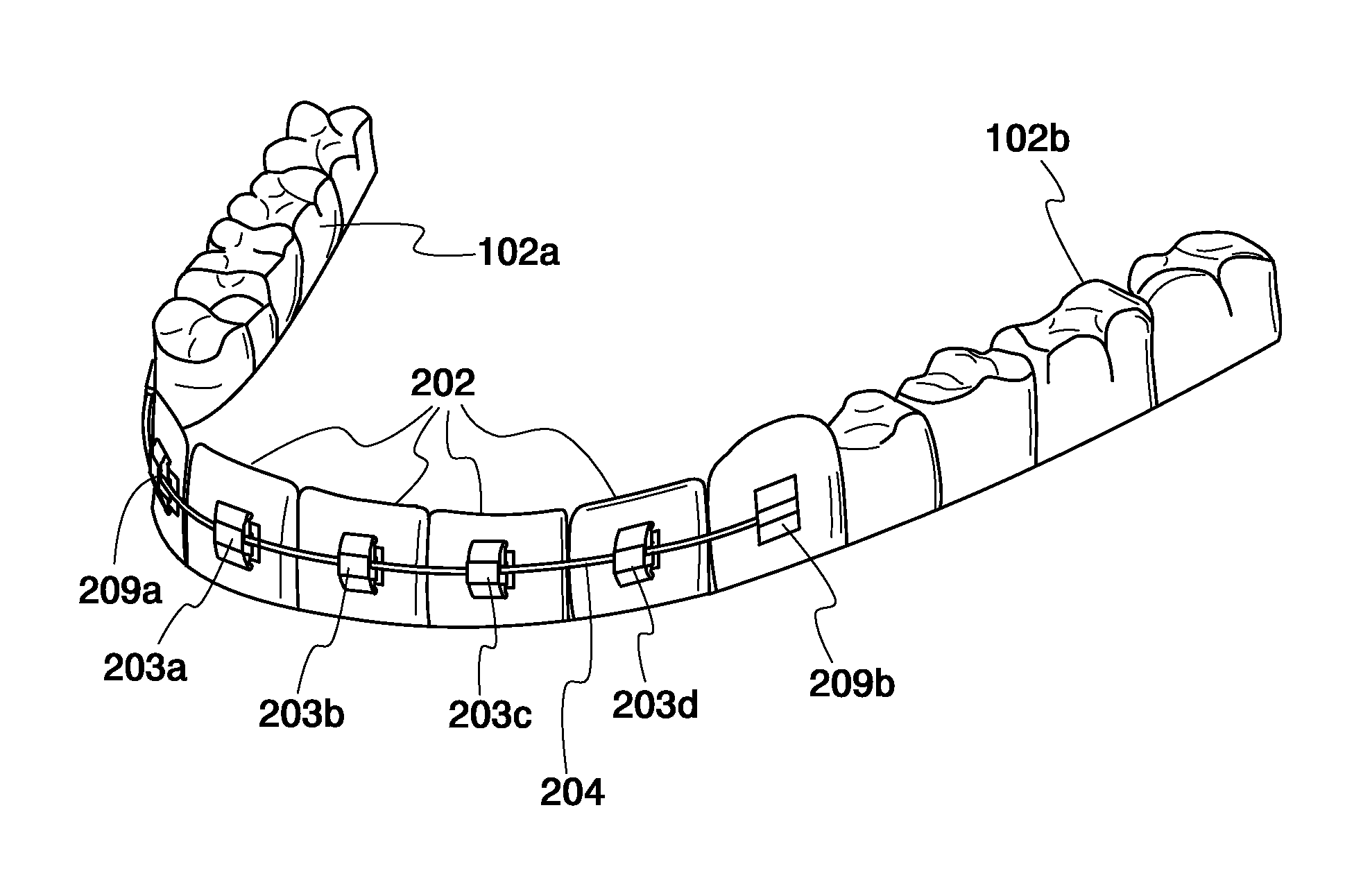 System for moving and aligning teeth