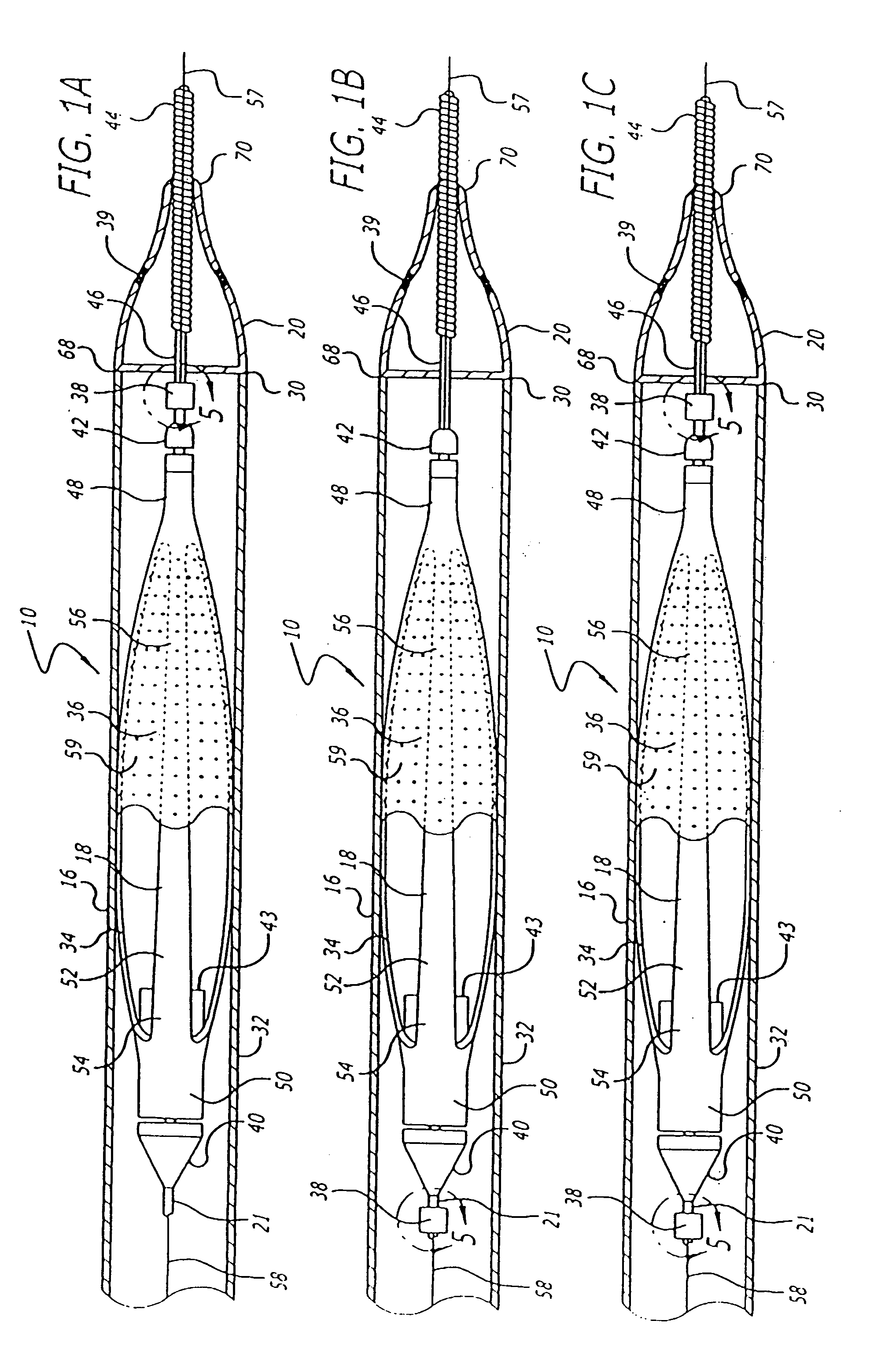 Hinged short cage for an embolic protection device