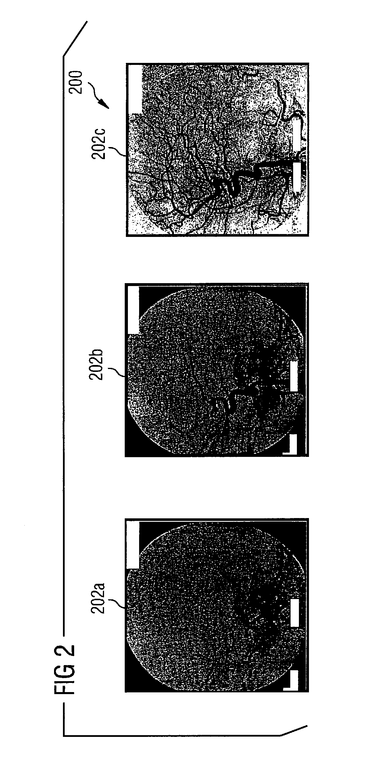 Method and apparatus for visualization of 2D/3D fused image data for catheter angiography