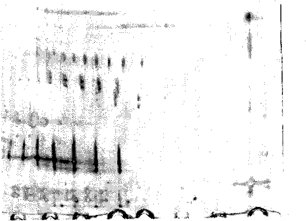 Method for preparing saliva protein sample