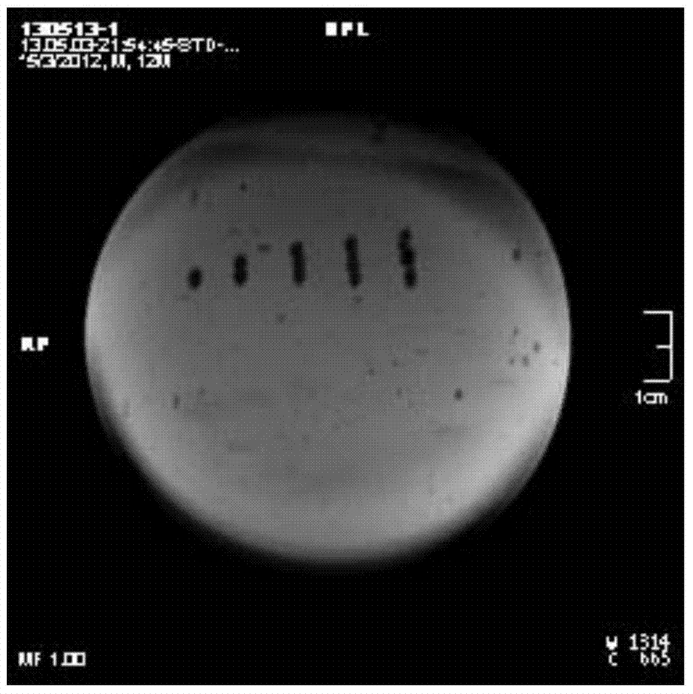 Embolic material, and preparation method and use thereof