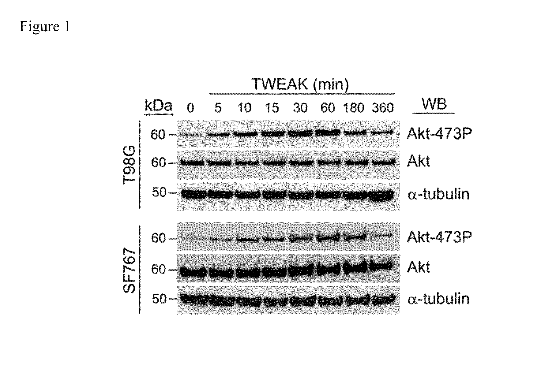 Methods used in identifying glioblastoma