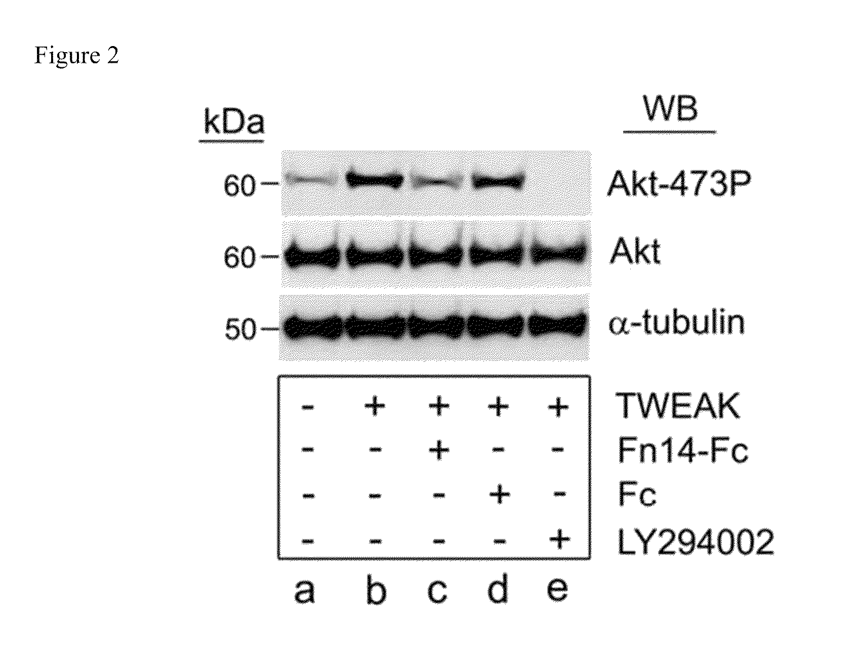 Methods used in identifying glioblastoma