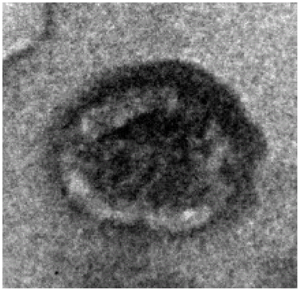 Novel gas-generating photoacoustic imaging contrast agent and preparation method thereof