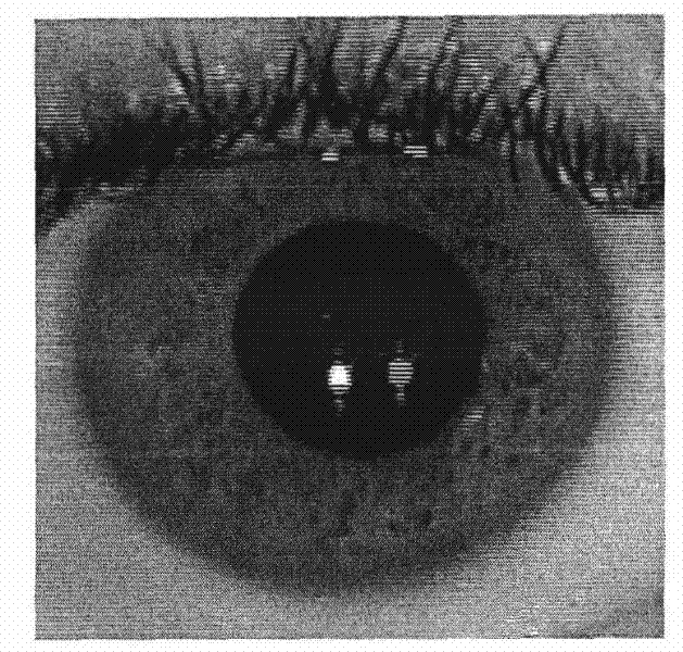 In vivo iris detection method