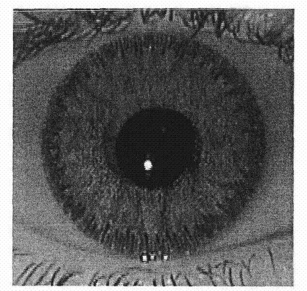 In vivo iris detection method