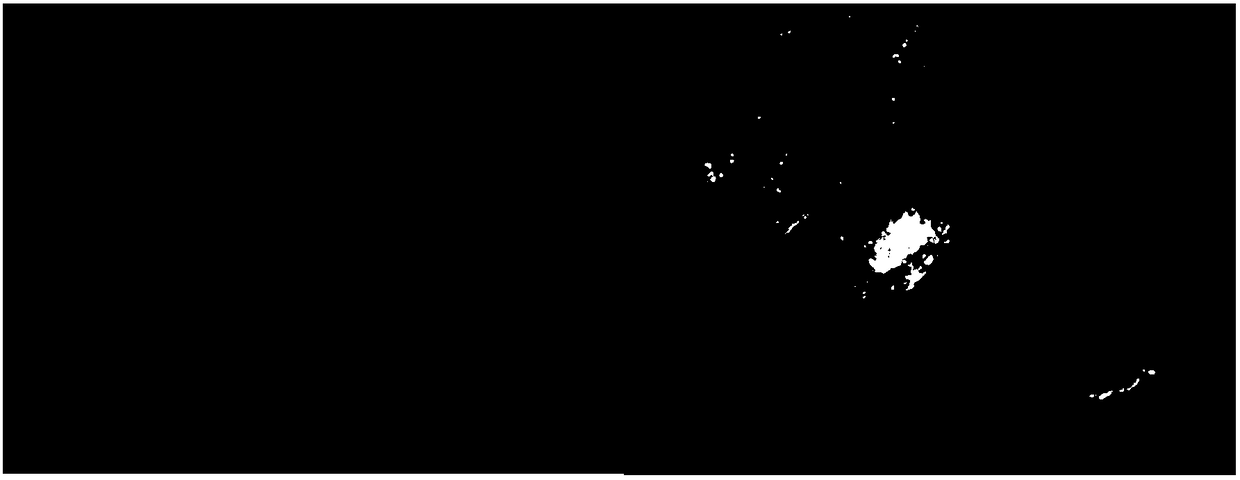 Method for obtaining embryogenic callus of foxtail millet for genetic transformation and method of genetic transformation