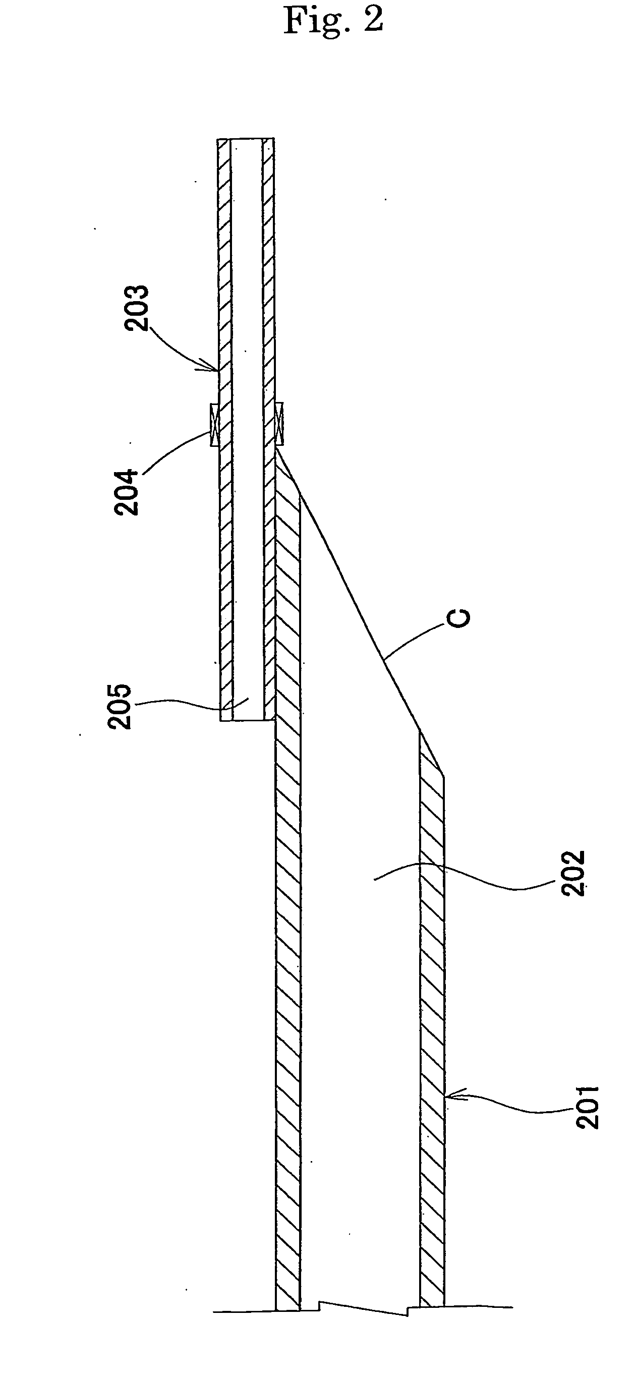 Suction catheter