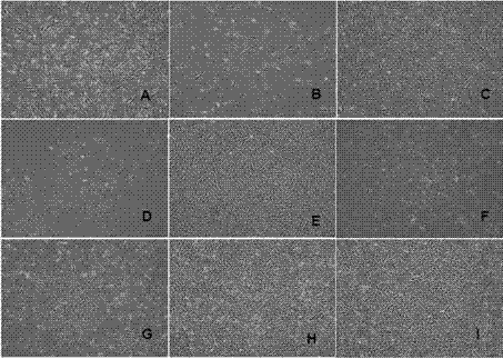 Medium without animal source components for cultivating human mesenchymal stem cells