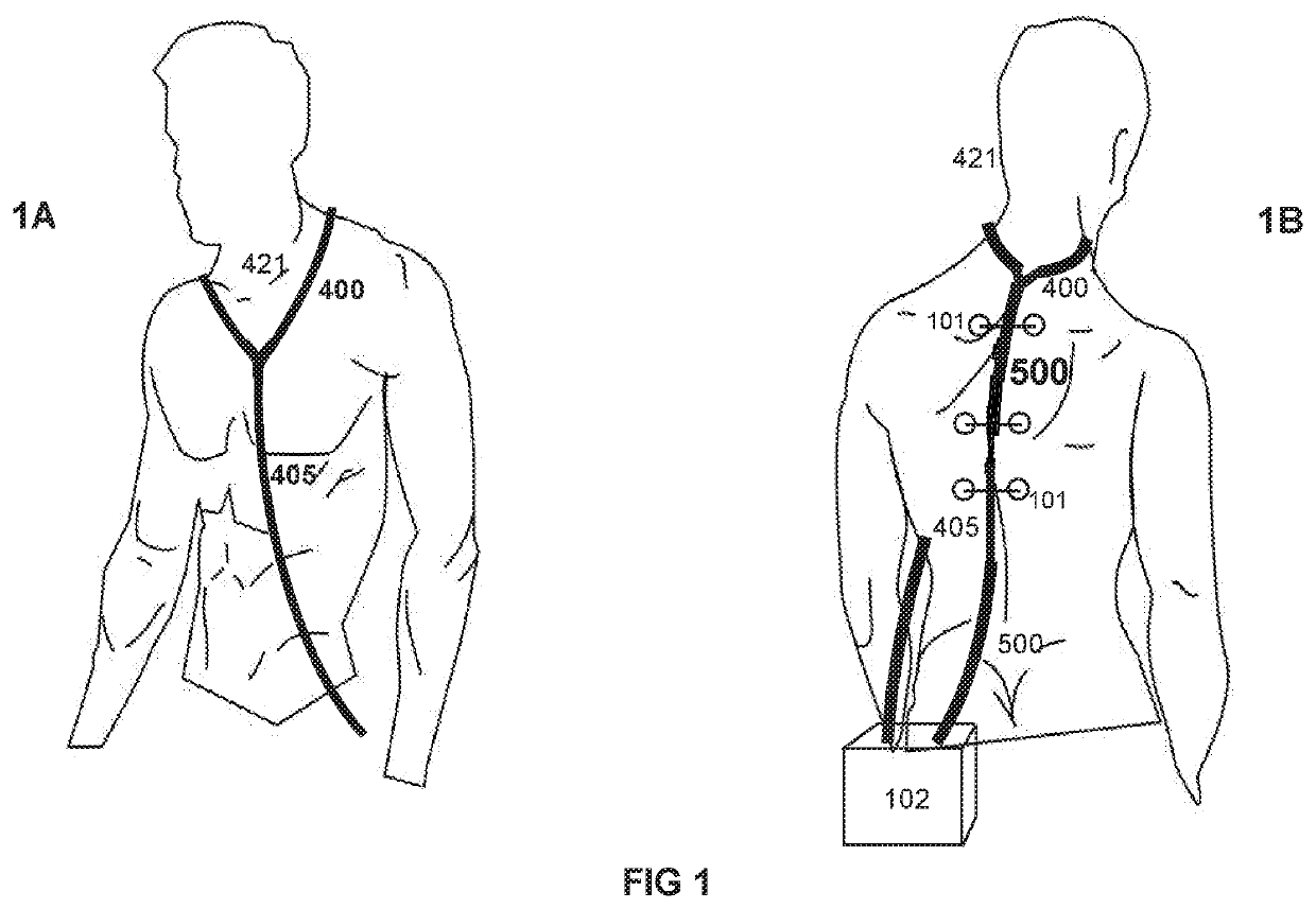 Equipment to elicit frissons or aesthetic chills, through the multisensorial and multimodal stimulation; with the objective of relieving chronic pains and the method to use it