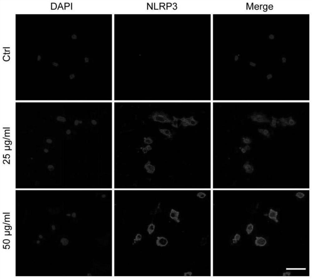 Application of CY-09 in preparation of medicine for resisting joint prosthesis wear particle induced osteolysis