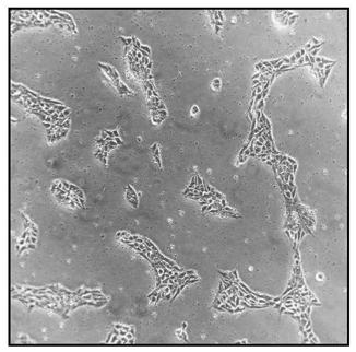 A method for efficient differentiation of induced pluripotent stem cells into mature endothelial cells