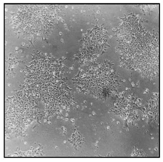 A method for efficient differentiation of induced pluripotent stem cells into mature endothelial cells