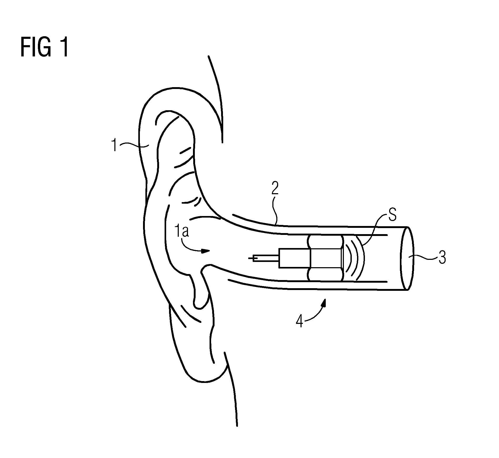 Inflatable ear mold connection system