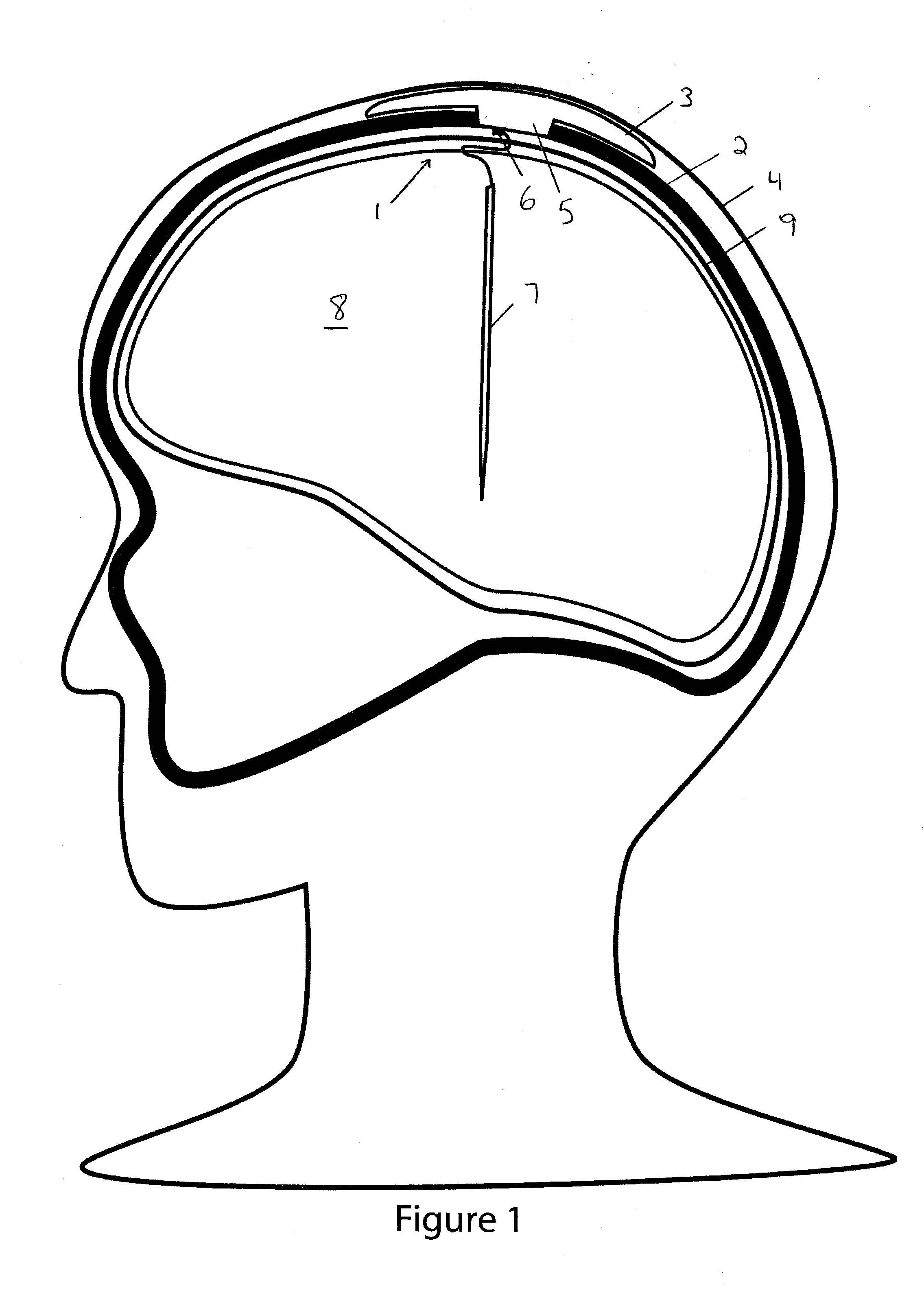 Implantable transcranial pulse generator having a collapsible portion