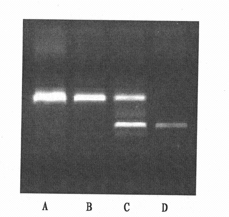 Reagent kit for detecting agedness yellow spot degenerative disease