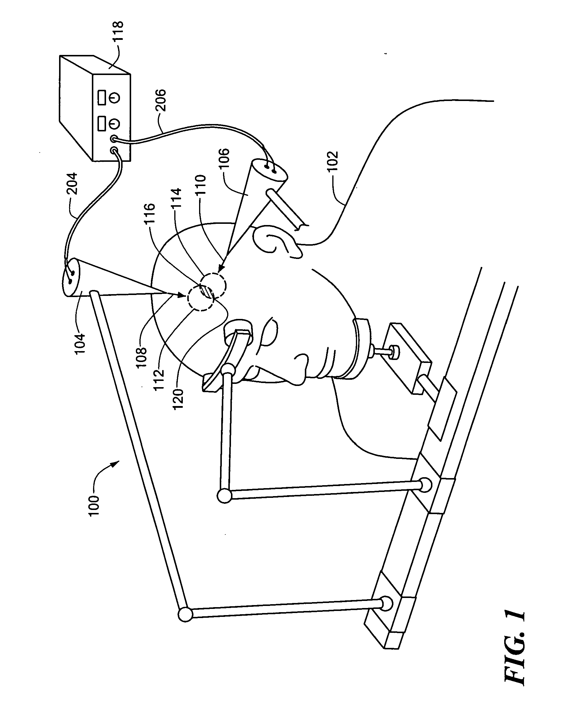 Magnetic stimulator