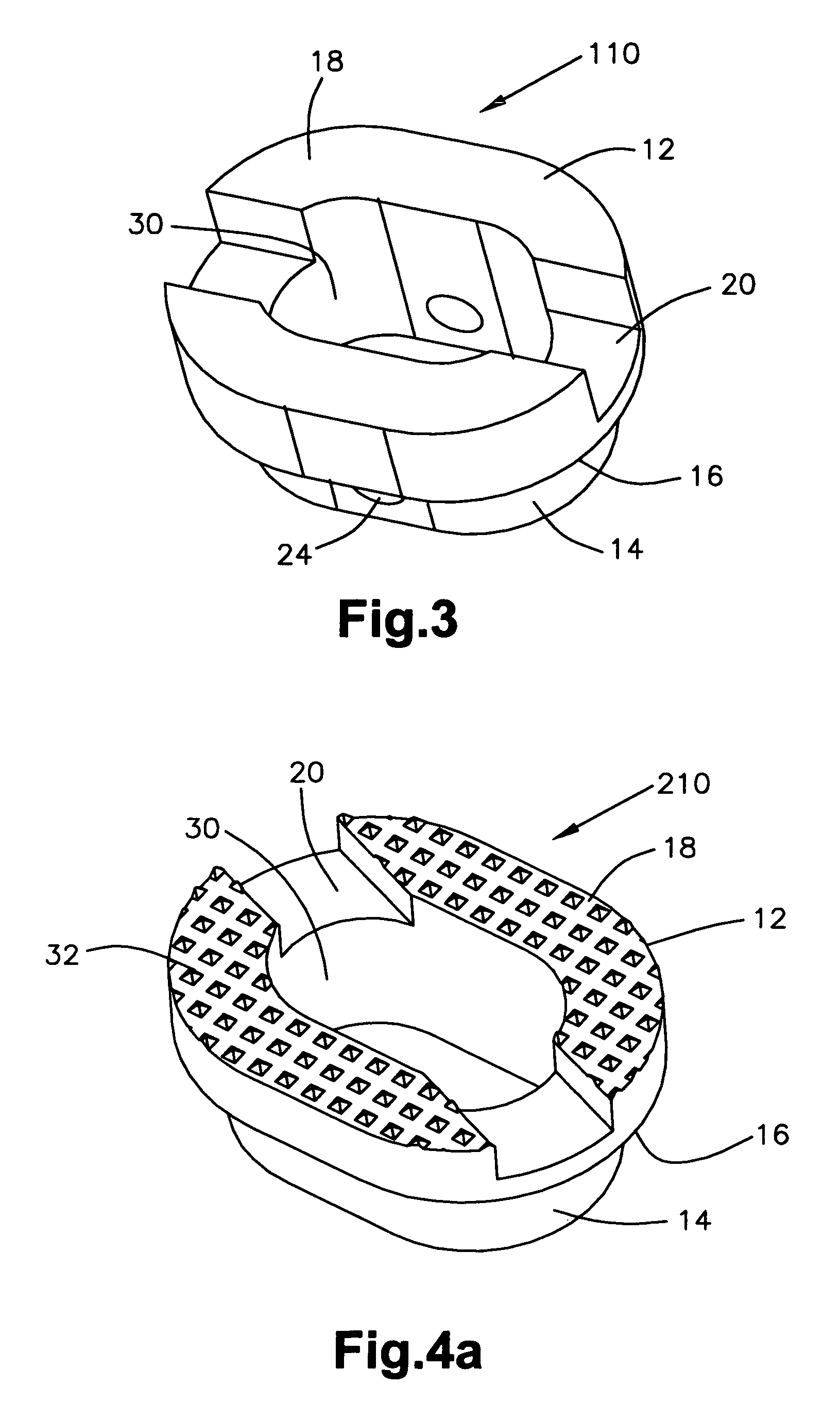 End member for a bone fusion implant