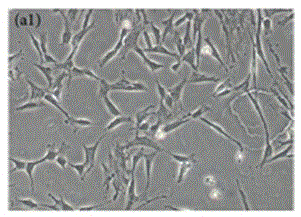 Application of compound cytokines of human umbilical cord mesenchymal stem cells in the preparation of biological preparations for repairing skin damage