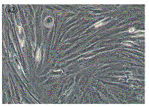 Application of compound cytokines of human umbilical cord mesenchymal stem cells in the preparation of biological preparations for repairing skin damage