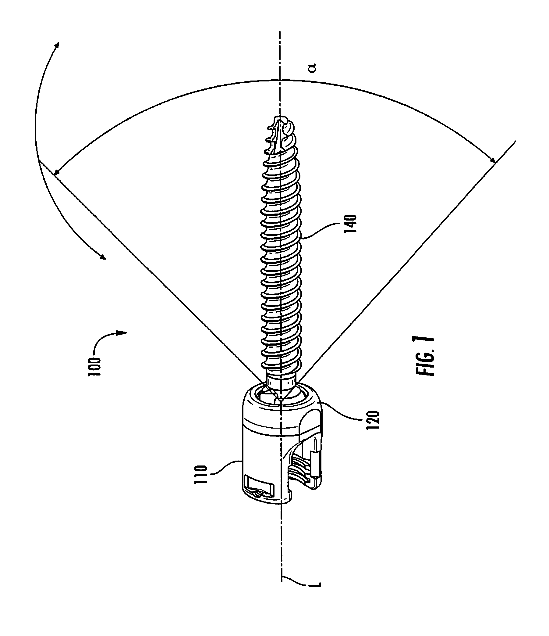 Spinal fixation system