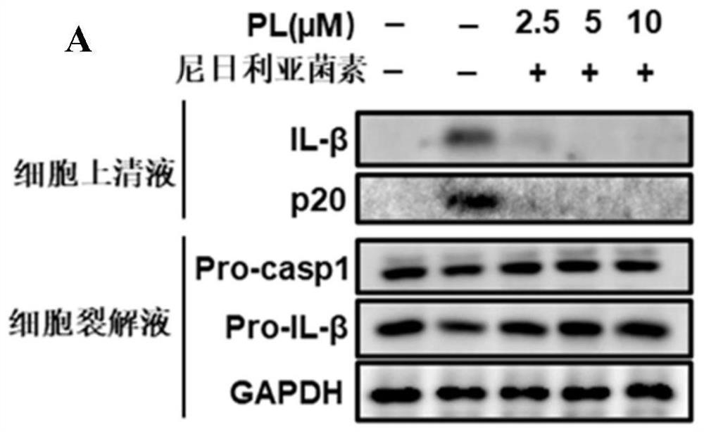 Application of piperlongumine in inhibition of NLRP3 inflammasome activation