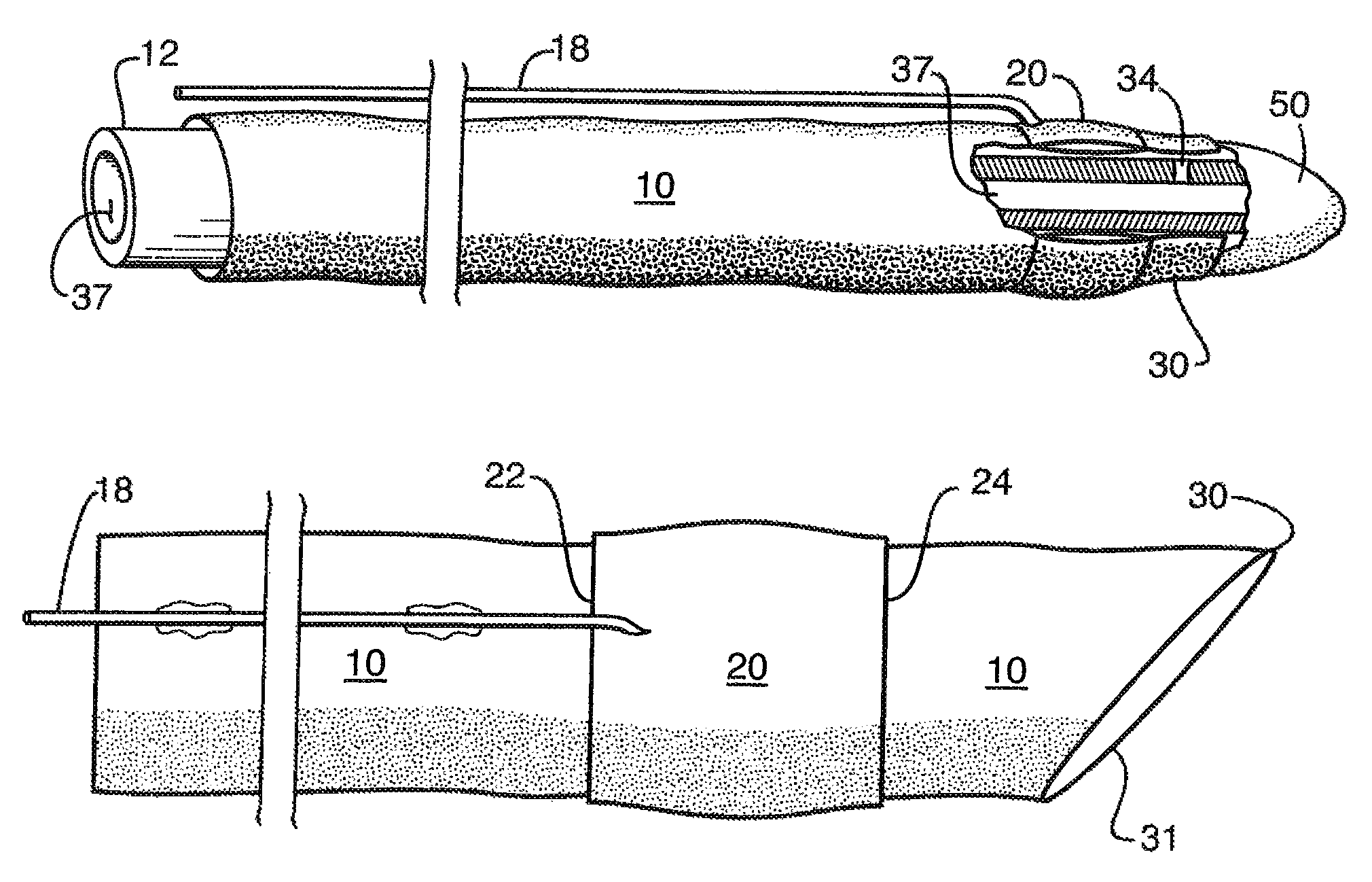 Flaccid tubular membrane and insertion appliance for surgical intubation