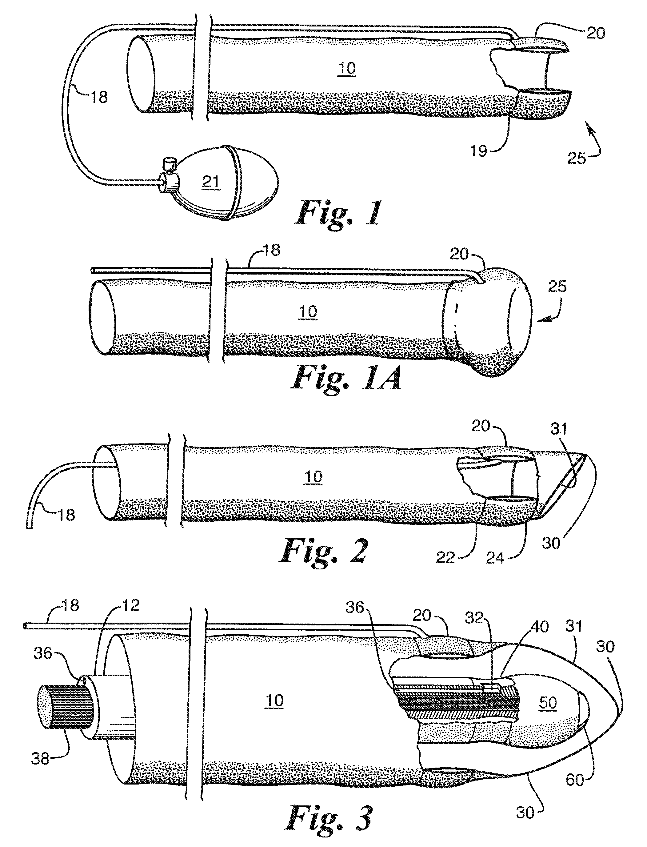 Flaccid tubular membrane and insertion appliance for surgical intubation