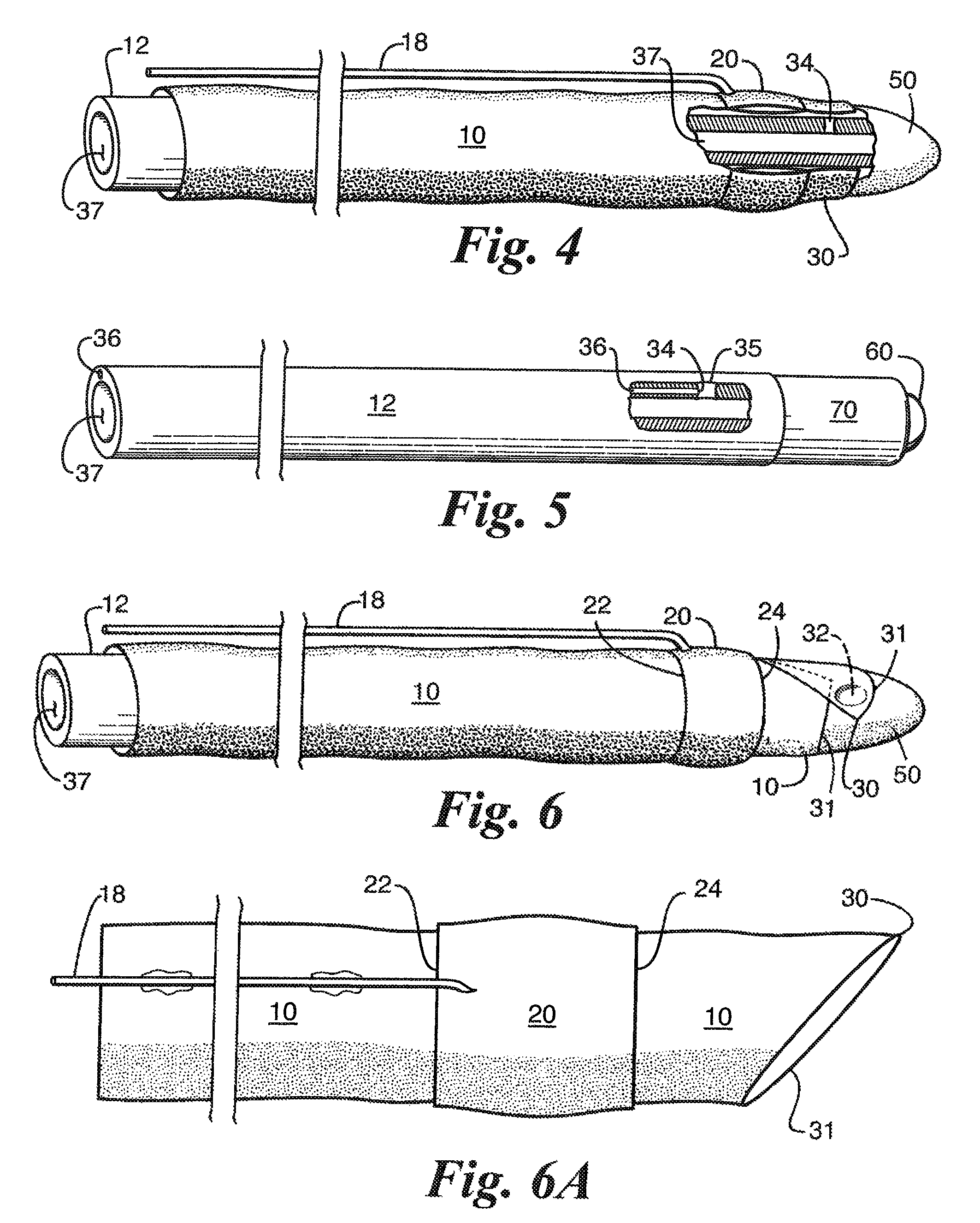 Flaccid tubular membrane and insertion appliance for surgical intubation