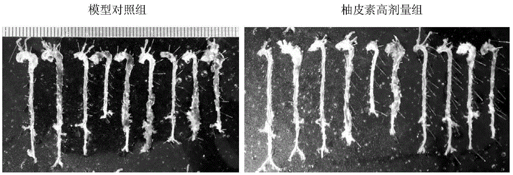 Application of naringenin to preparation of drugs for preventing and/or treating aortic dissection