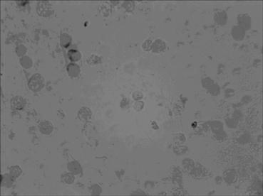 Level in situ hybridization detection kit for detecting MICRORNA-16-1 in earlier period of pathological changes of cancers as well as detection method and application