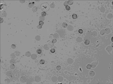 Level in situ hybridization detection kit for detecting MICRORNA-16-1 in earlier period of pathological changes of cancers as well as detection method and application