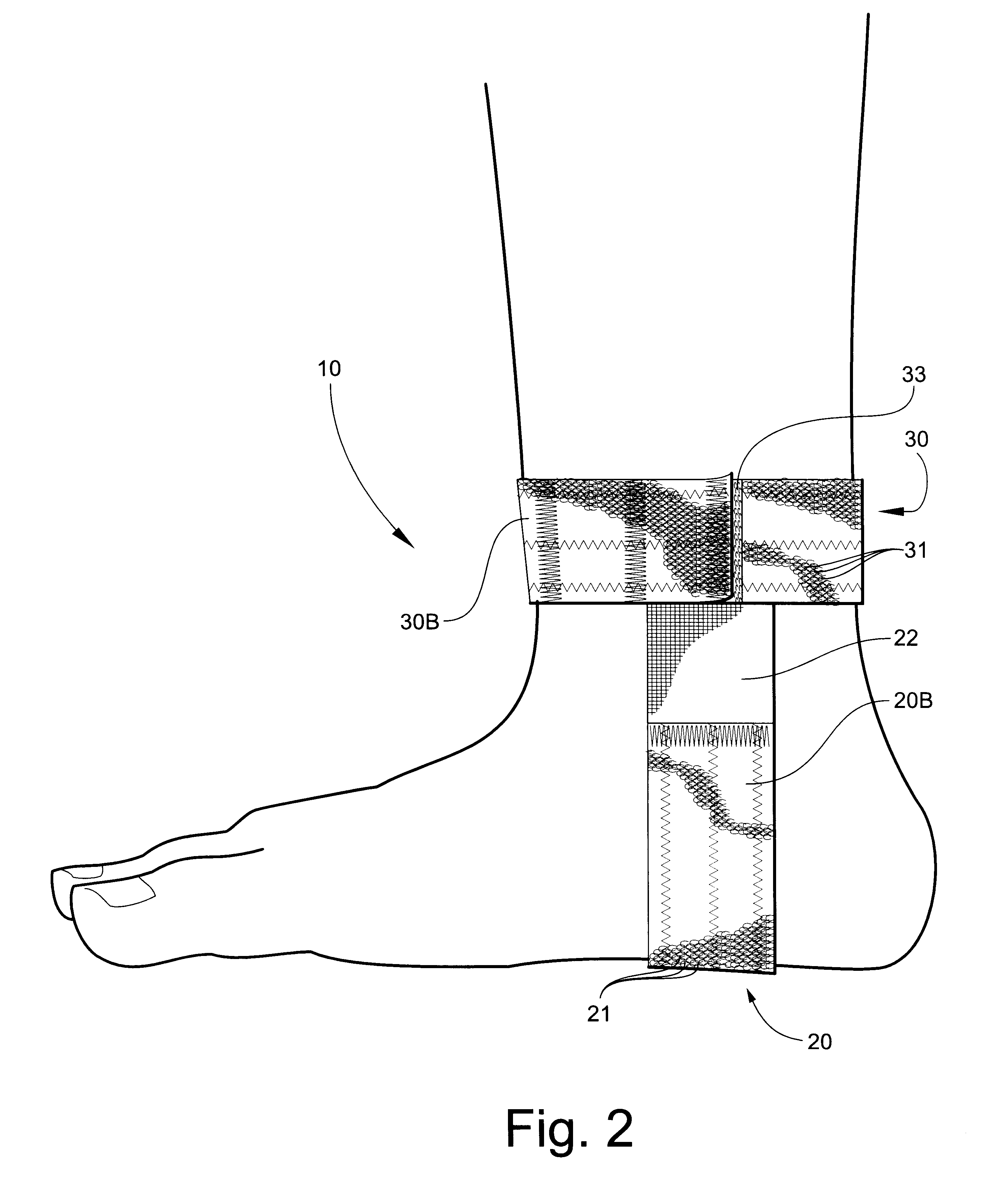 Plantar fascitis support apparatus