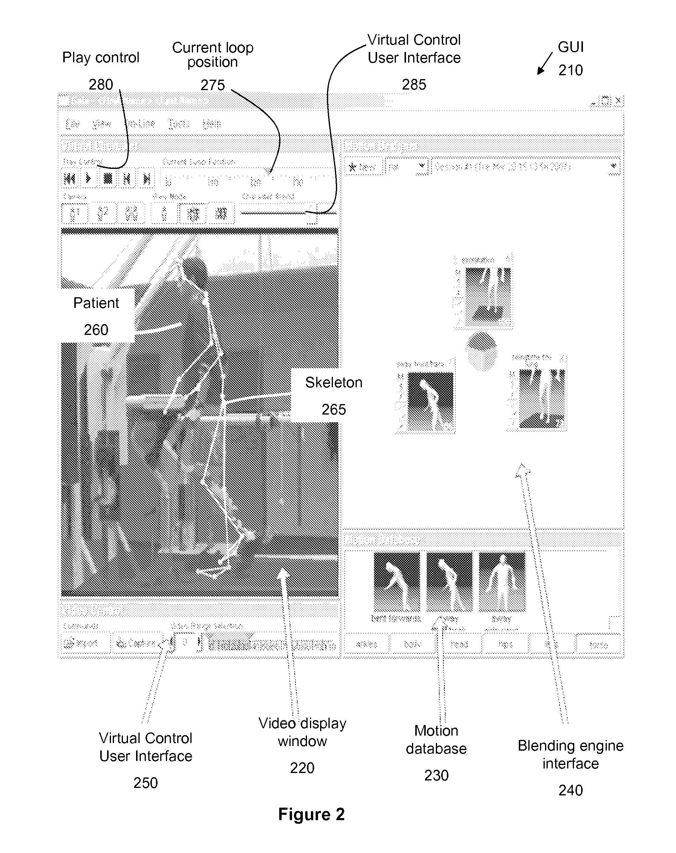 Method and system for real time interactive dynamic alignment of prosthetics