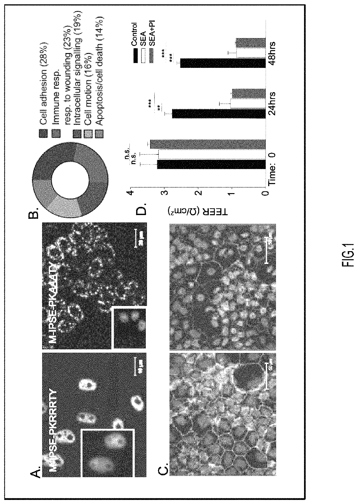 Use of interleukin-4-inducing principle of <i>Schistosoma mansoni </i>eggs for treating pain, interstitial cystitis and/or overactive bladder