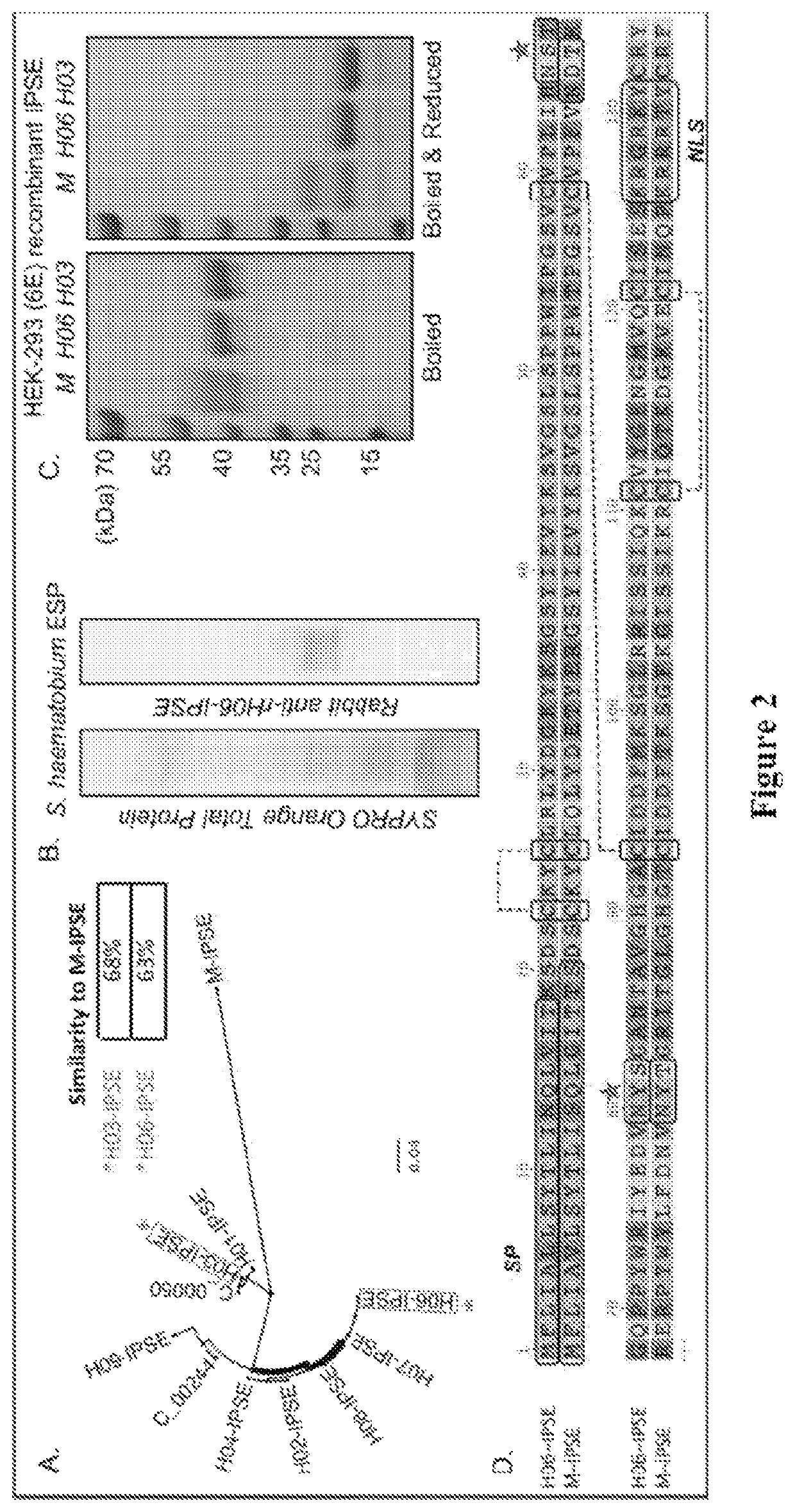 Use of interleukin-4-inducing principle of <i>Schistosoma mansoni </i>eggs for treating pain, interstitial cystitis and/or overactive bladder