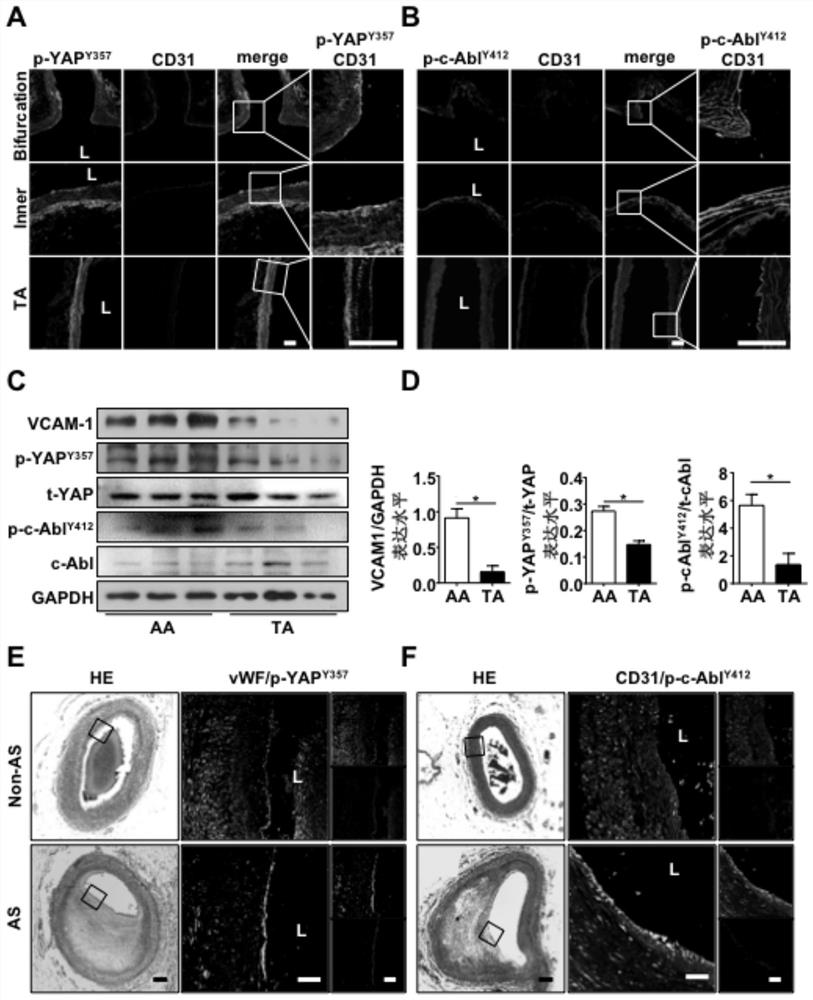 Application of substances that inhibit phosphorylation of 357th tyrosine residue of yap protein in preventing atherosclerosis