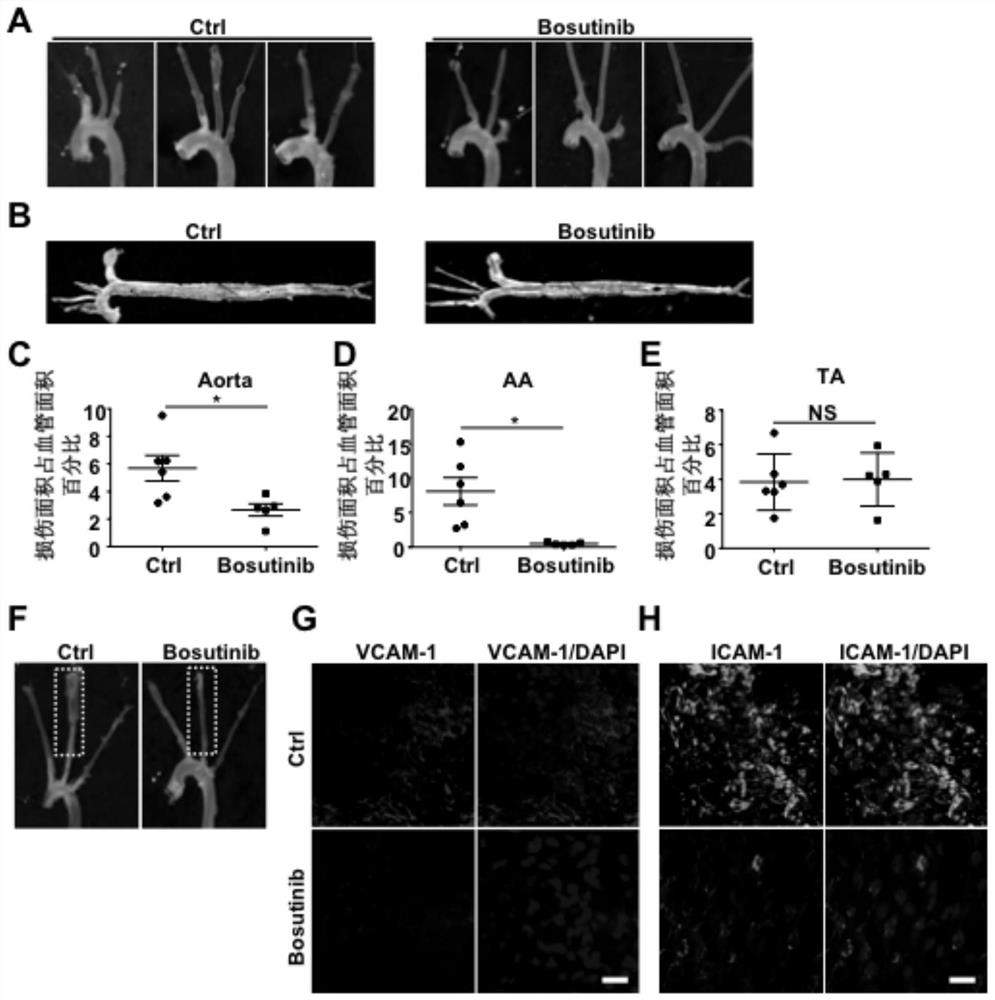 Application of substances that inhibit phosphorylation of 357th tyrosine residue of yap protein in preventing atherosclerosis