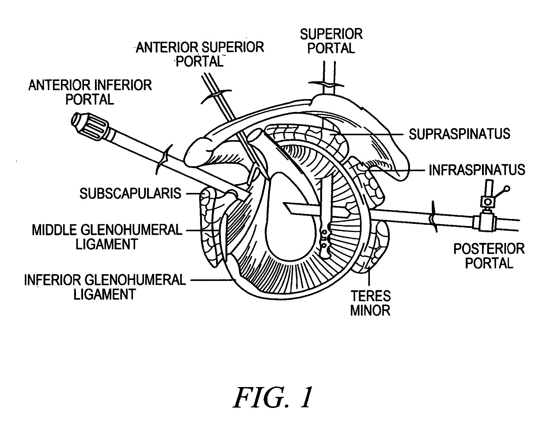 Devices, systems and methods for tissue repair