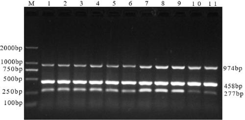 Multiple RT-PCR (reverse transcription-polymerase chain reaction) detection primer group and kit for rapidly distinguishing PEDV (porcine epidemic diarrhea virus), TEGV (porcine transmissible gastroenteritis) and PReoV (porcine reovirus)