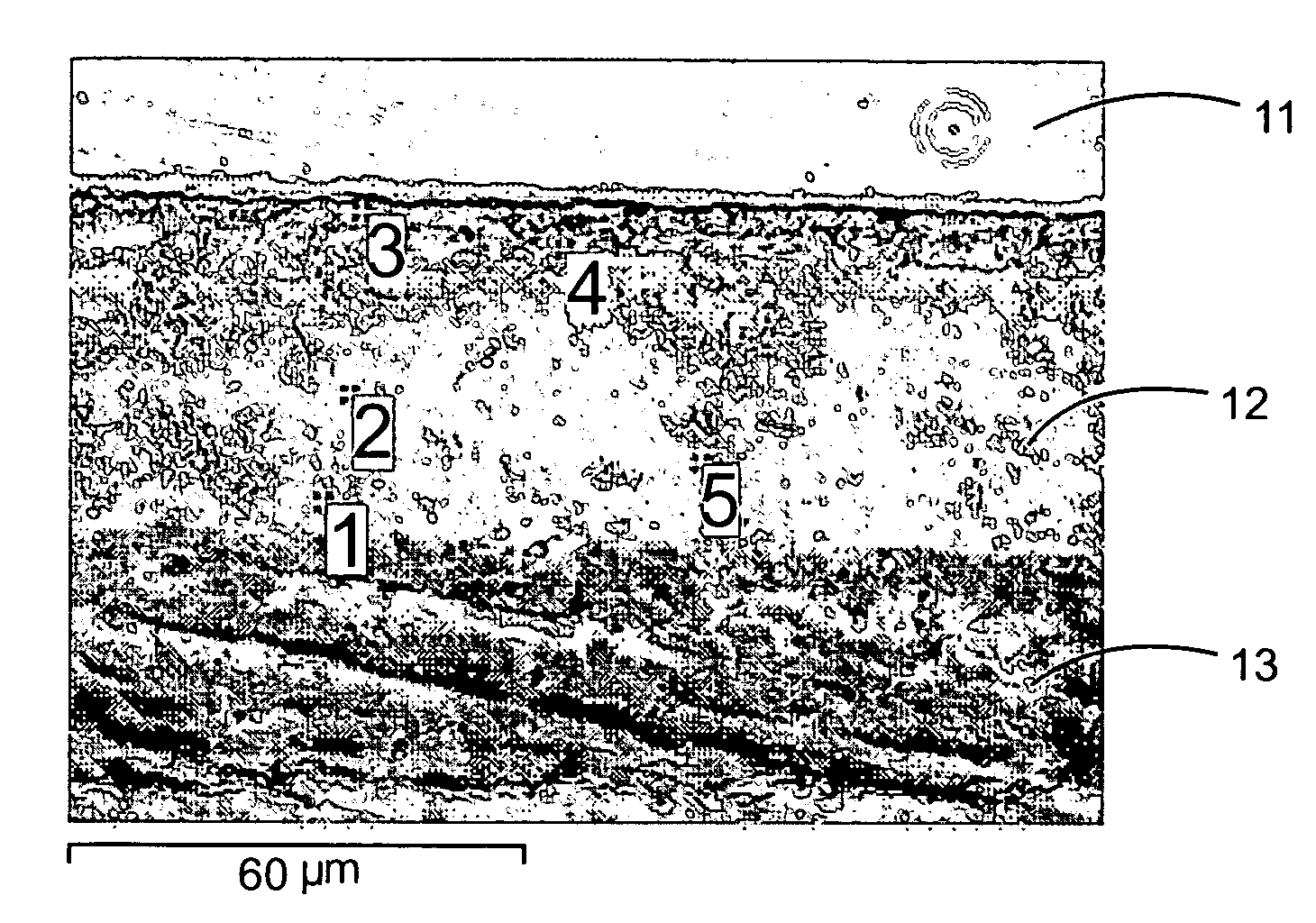 Bioceramic coating of a metal-containing substrate