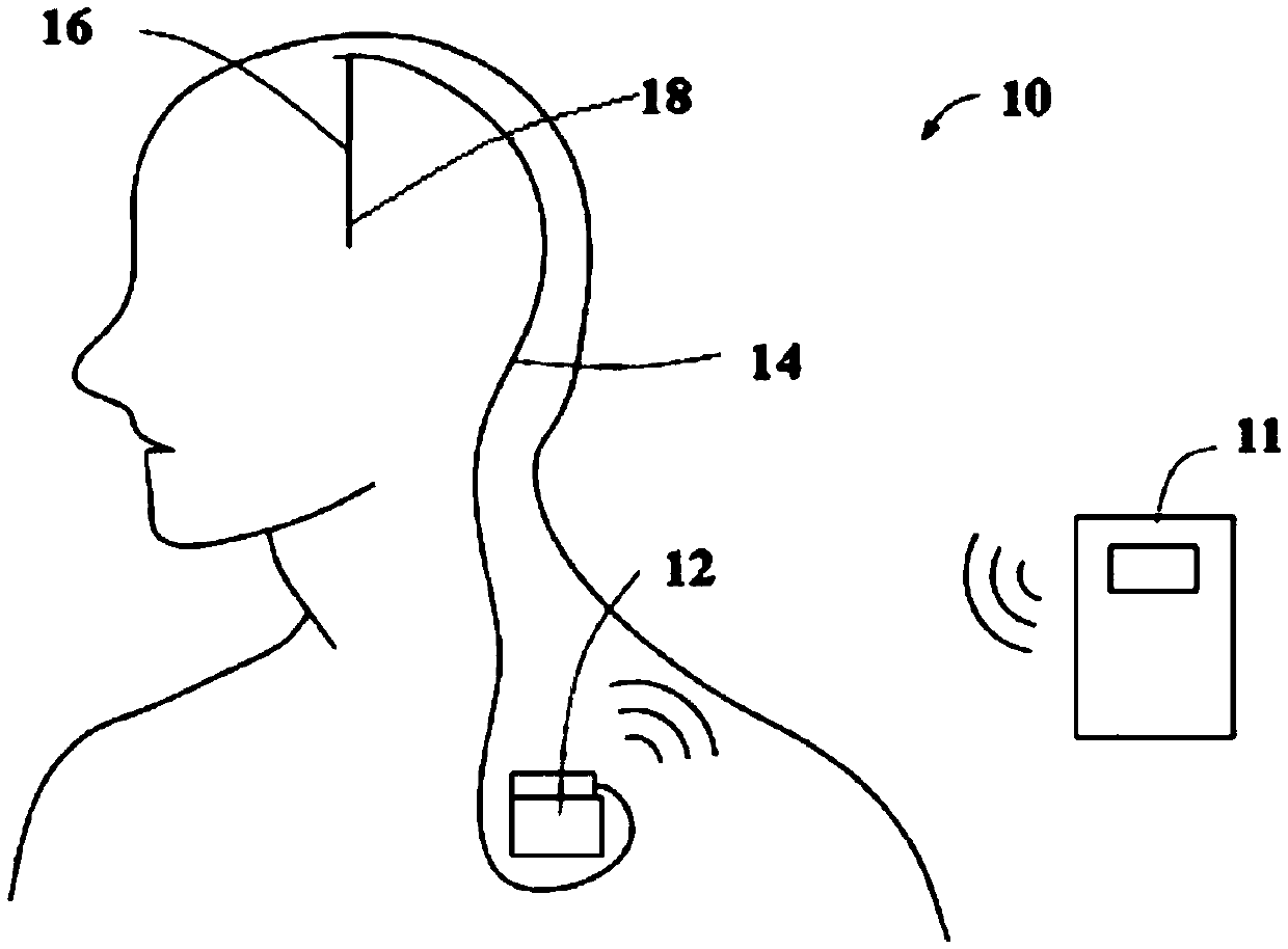 A method and magnetic resonance imaging system for monitoring the temperature of tissue surrounding an active implant