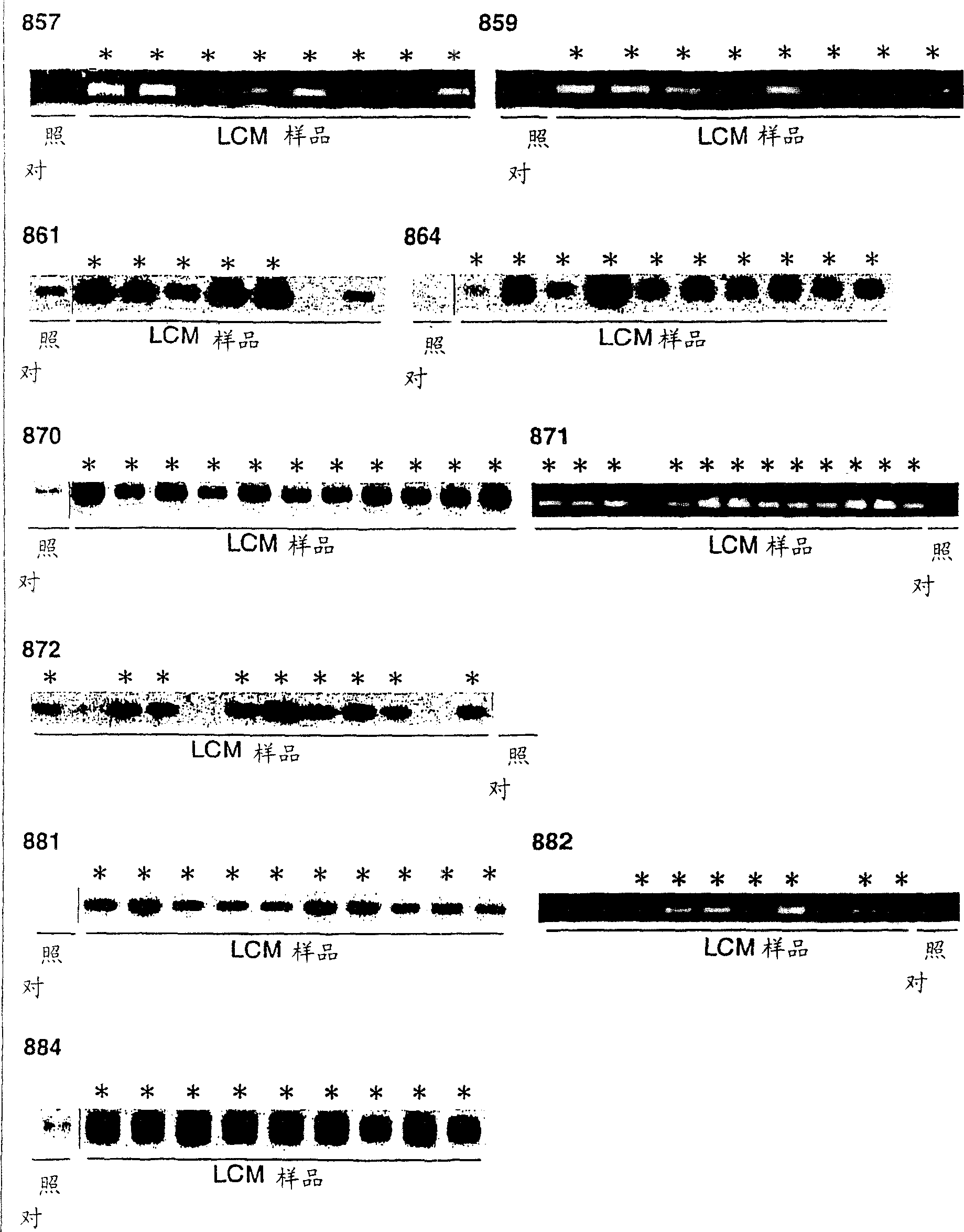 Method for diagnosing non-small cell lung cancers